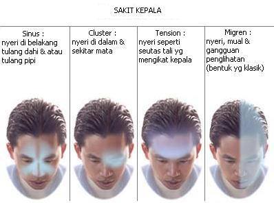aneka sakit kepala