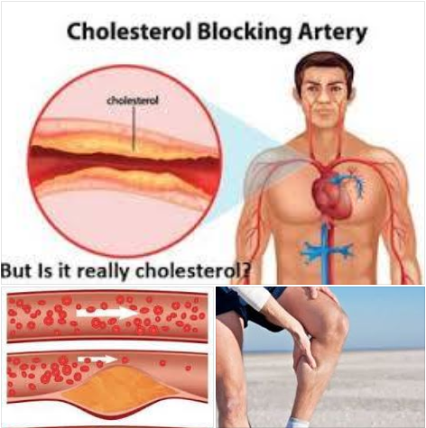 Kolesterol